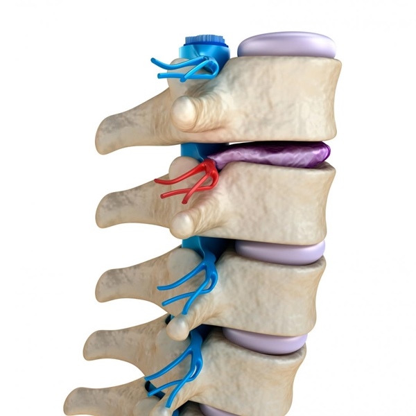 DEGENERAÇÃO DISCAL